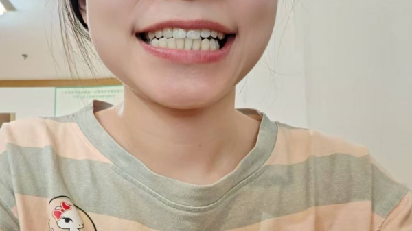 叩齿