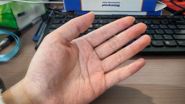 一暄康养分享夏天手脚发热是什么原因