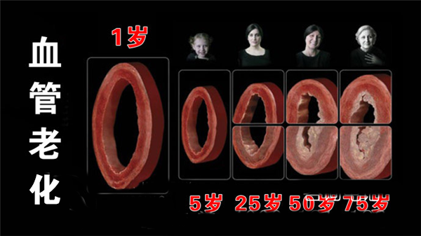 成都养老院一暄康养组织开展老年人常见慢性病的防治及护理培训