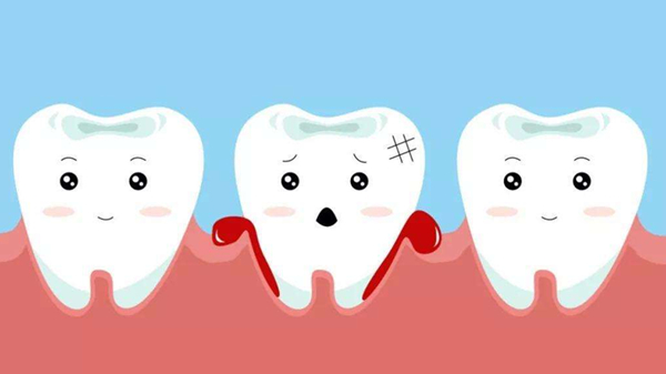 有这些症状，成都养老院一暄康养提醒您可能是牙龈发炎（二）-牙龈出血