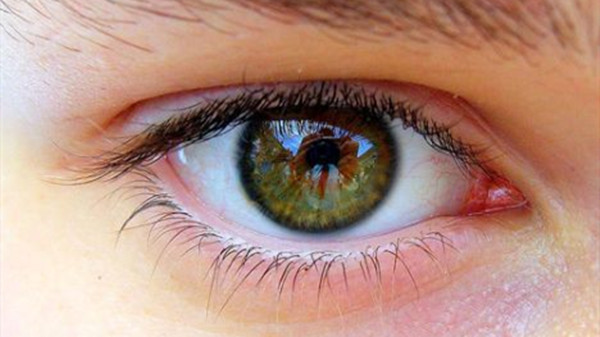 成都养老院一暄康养警惕夏日紫外线对眼睛的伤害（二）-眼睛3