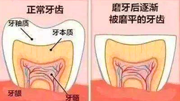 成都好的养老院-一暄康养分享晚上睡觉磨牙是什么原因（二）-磨牙1