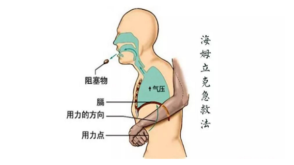 成都金牛区养老院一暄康养：老人噎食怎么办！