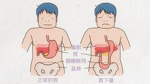 胃炎胃下垂的饮食调理，跟着成都金牛区养老院一暄康养一起学习（三）