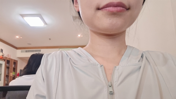 一暄康养分享下巴长痘痘怎么调理